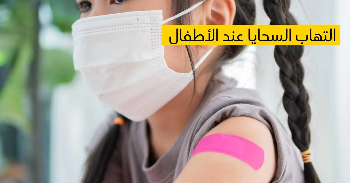  إلتهاب السحايا عند الأطفال